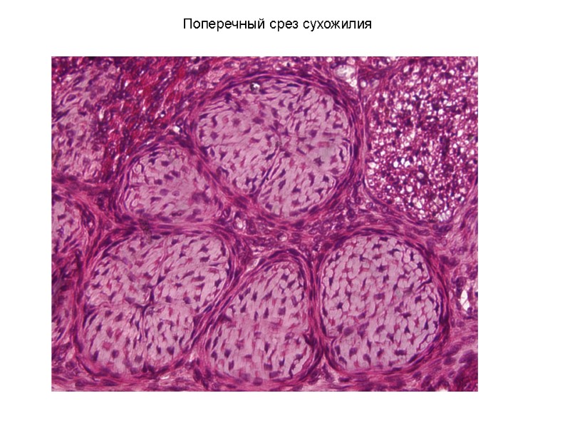 Поперечный срез сухожилия